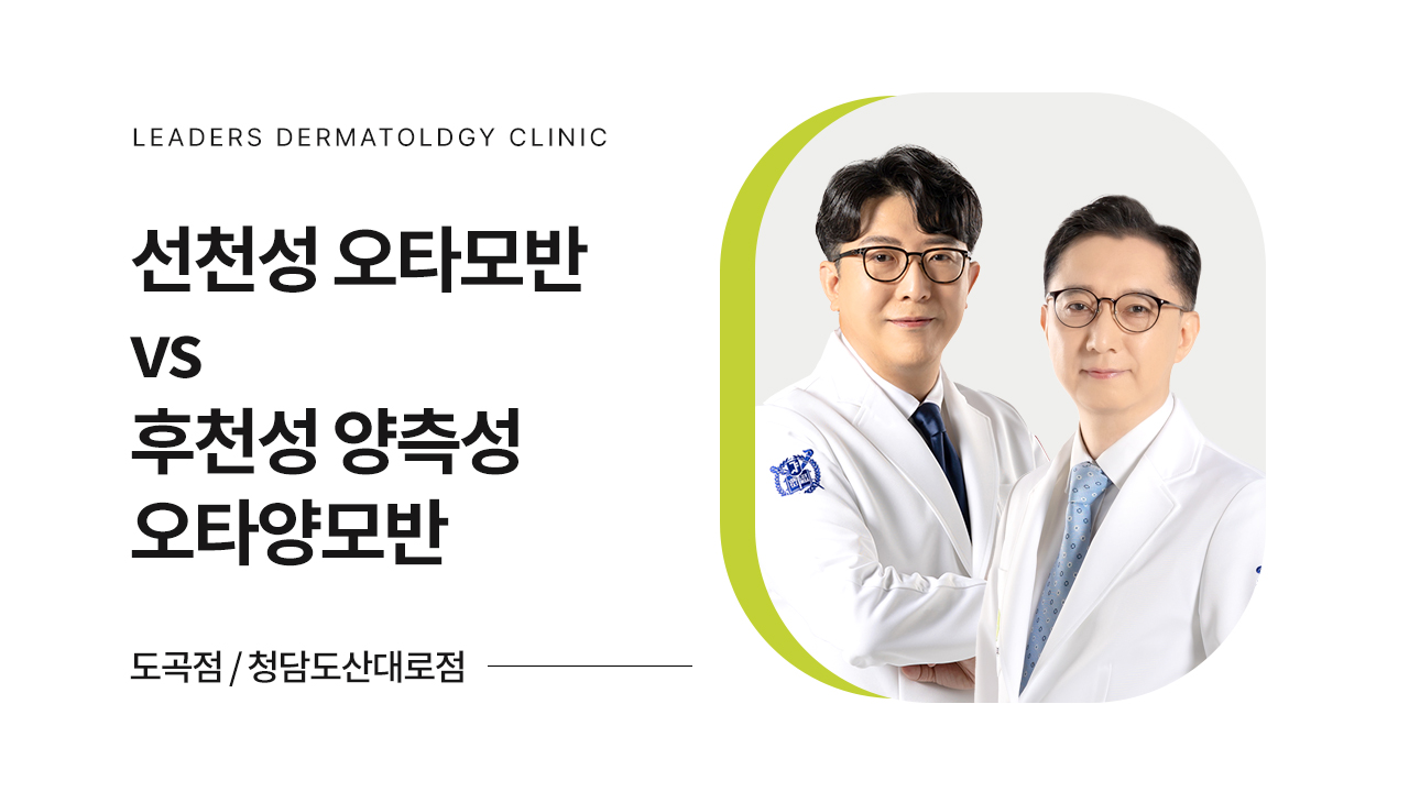 선천성 오타모반 vs 후천성 양측성 오타양모반