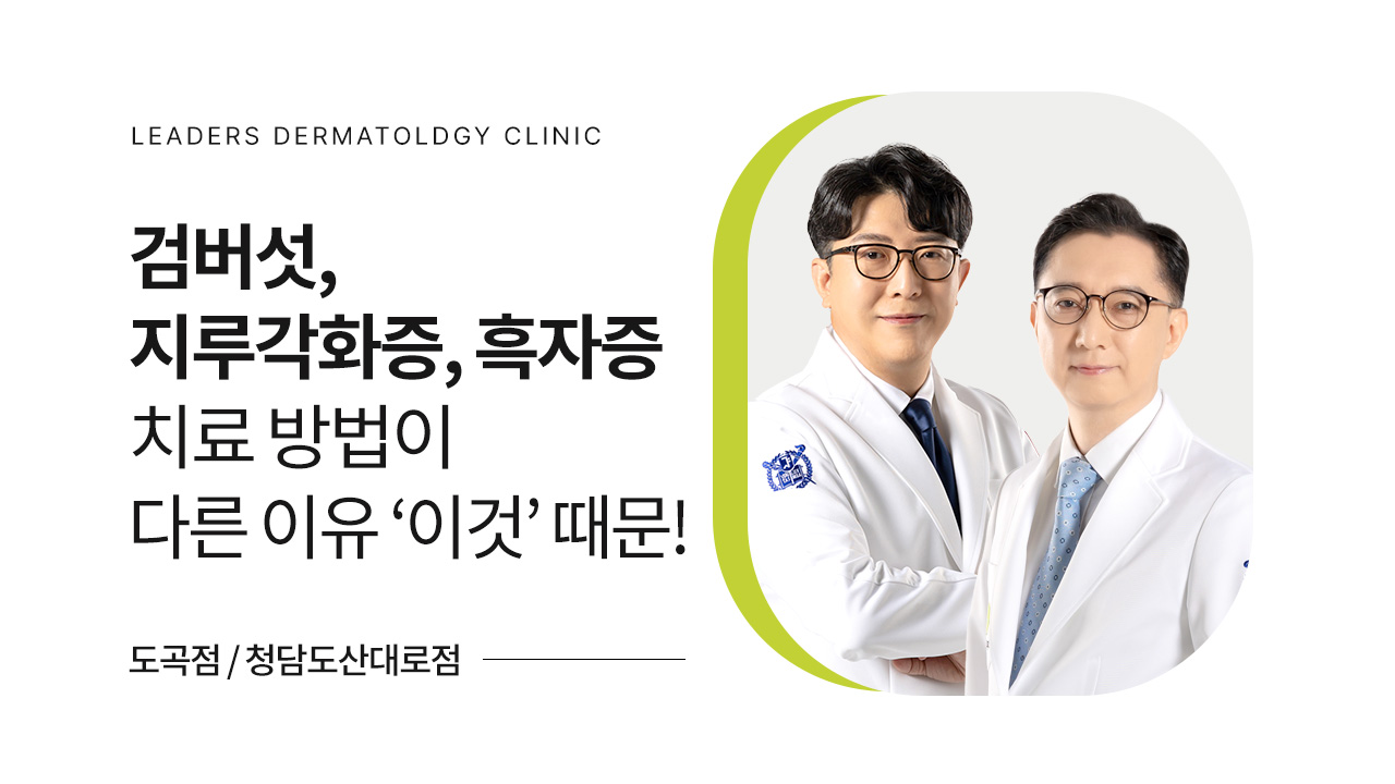 검버섯, 지루각화증, 흑자증
